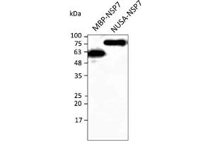 Western Blotting (WB) image for anti-SARS-CoV-2 Non-Structural Protein 7 (NSP7) antibody (ABIN7273019) (SARS-CoV-2 NSP7 Antikörper)
