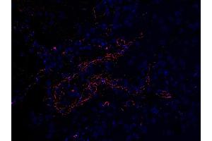Immunofluoorescent l analysis of paraffin-embedded COVID-19 patient lung tissue using anti- SARS-CoV-2 (COVID-19) Envelope antibody (ABIN1031551, 2 μg/mL). (SARS-CoV-2 Envelope Antikörper  (N-Term))