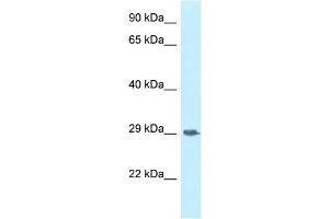 WB Suggested Anti-SIRPG Antibody Titration: 1. (SIRPG Antikörper  (Middle Region))