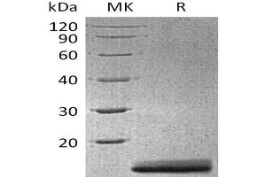 Western Blotting (WB) image for Anterior Gradient 3 (AGR3) protein (His tag) (ABIN7320852) (AGR3 Protein (His tag))