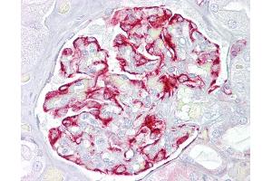 Immunohistochemistry (IHC) image for anti-Activin Receptor Type I (ACRV1) (AA 80-129) antibody (ABIN6748601)