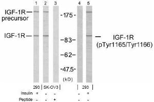 Image no. 1 for anti-Insulin-Like Growth Factor 1 Receptor (IGF1R) (pTyr1165), (pTyr1166) antibody (ABIN197244) (IGF1R Antikörper  (pTyr1165, pTyr1166))
