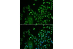 Immunofluorescence (IF) image for anti-LSM4 Homolog, U6 Small Nuclear RNA Associated (LSM4) antibody (ABIN1980258) (LSM4 Antikörper)