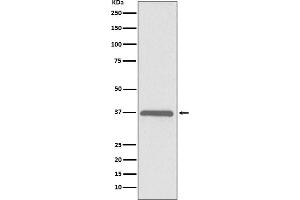 Western blot analysis of ERCC1 expression in HeLa cell lysate.