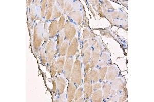 Immunohistochemistry (IHC) image for anti-Myosin Heavy Chain 4, Skeletal Muscle (MYH4) (AA 1450-1550) antibody (ABIN7268749)