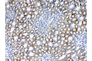 IHC testing of FFPE rat kidney tissue with RPS6 antibody at 1ug/ml. (RPS6 Antikörper  (AA 13-52))