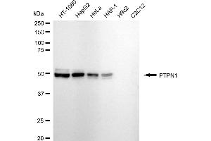 Western blotting analysis using PTPN1 antibody (ABIN7800039).