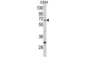 Western blot analysis of ND5 Antibody (C-term) in CEM cell line lysates (35ug/lane). (MT-ND5 Antikörper  (C-Term))