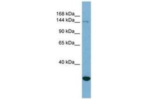 Image no. 1 for anti-Jumonji, AT Rich Interactive Domain 2 (JARID2) (AA 215-264) antibody (ABIN6741955) (JARID2 Antikörper  (AA 215-264))