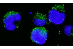 Immunofluorescence (IF) image for anti-Breakpoint Cluster Region (BCR) (AA 1221-1271) antibody (ABIN7453394)