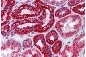 Human Kidney: Formalin-Fixed, Paraffin-Embedded (FFPE)