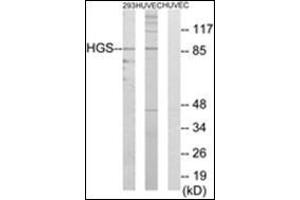 Western blot analysis of extracts from 293/HuvEc cells, using HGS Antibody. (HGS Antikörper  (Internal Region))