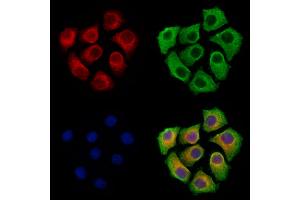 ABIN7094862 and ABIN7098913 staining Hela cells by IF/ICC.