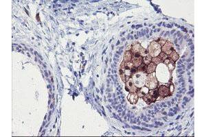 Immunohistochemical staining of paraffin-embedded Human breast tissue using anti-SDS mouse monoclonal antibody. (serine Dehydratase Antikörper)