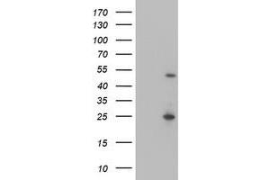 Western Blotting (WB) image for anti-Myocyte Enhancer Factor 2C (MEF2C) antibody (ABIN1499363) (MEF2C Antikörper)