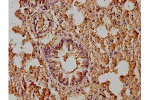 IHC image of ABIN7176993 diluted at 1:400 and staining in paraffin-embedded mouse lung tissue performed on a Leica BondTM system.