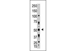 The GDF10 polyclonal antibody  is used in Western blot to detect GDF10 in A-375 cell lysate. (GDF10 Antikörper  (N-Term))