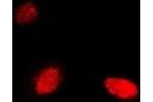 Immunofluorescent analysis of NUDT2 staining in Hela cells. (NUDT2 Antikörper)