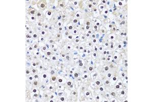 Immunohistochemistry of paraffin-embedded mouse liver using CCAR2 antibody. (CCAR2 Antikörper)