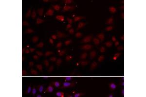 Immunofluorescence analysis of HeLa cells using CST2 Polyclonal Antibody (CST2 Antikörper)
