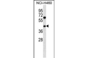Western blot analysis in NCI-H460 cell line lysates (35ug/lane). (PUS1 Antikörper  (C-Term))
