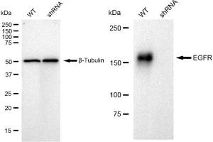 Western blotting analysis using EGFR antibody (ABIN7798462).