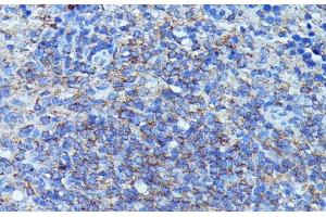 Immunohistochemistry of paraffin-embedded Mouse spleen using CSF3 Polyclonal Antibody at dilution of 1:100 (40x lens). (G-CSF Antikörper)