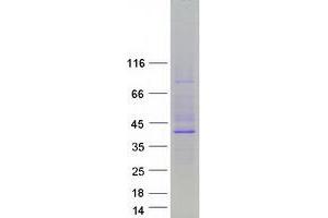 Western Blotting (WB) image for Cytochrome P450, Family 11, Subfamily A, Polypeptide 1 (CYP11A1) (Transcript Variant 2) protein (Myc-DYKDDDDK Tag) (ABIN2712750)