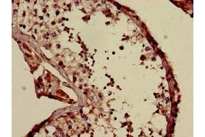 Immunohistochemistry of paraffin-embedded human testis tissue using ABIN7174238 at dilution of 1:100