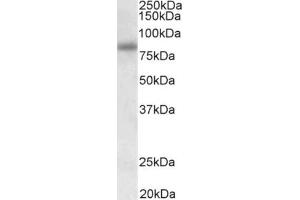AP31940PU-N SDCCAG8 staining of HEK293 lysate at 0. (SDCCAG8 Antikörper  (Internal Region))