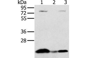 Western Blot analysis of Raji cell and Human liver cancer tissue, hela cell using NDUFAF2 Polyclonal Antibody at dilution of 1:250