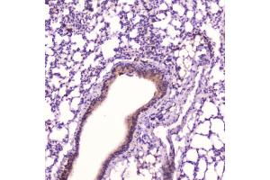 IHC testing of FFPE mouse lung tissue with Leptin antibody at 2ug/ml. (Leptin Antikörper  (AA 22-167))