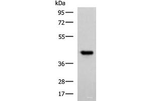 Western blot analysis of Ramos cell lysate using FCRLA Polyclonal Antibody at dilution of 1:750 (FCRLA Antikörper)