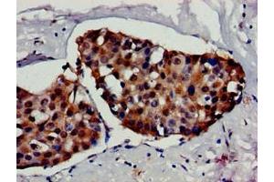 Immunohistochemistry (IHC) image for anti-Heat Shock Factor Protein 1 (HSF1) (AA 420-529) antibody (ABIN7154889)