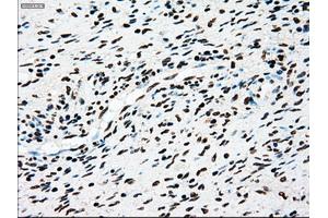 Immunohistochemical staining of paraffin-embedded Kidney tissue using anti-TYRO3mouse monoclonal antibody. (TYRO3 Antikörper)