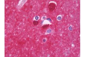 Anti-PPP3CB antibody IHC staining of human brain, cortex. (PPP3CB Antikörper  (AA 63-393))