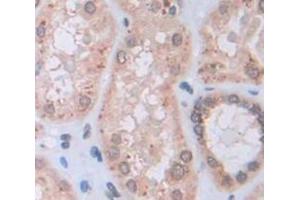 IHC-P analysis of Human Tissue, with DAB staining. (IDS Antikörper  (AA 95-289))