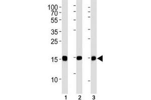 SUMO-2 antibody western blot analysis in (1) CEM, (2) 293, (3) rat C6 lysate. (SUMO2 Antikörper)