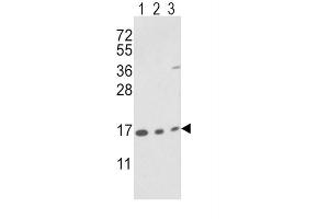 Western Blotting (WB) image for anti-Peptidylprolyl Isomerase A (Cyclophilin A) (PPIA) antibody (ABIN3001732) (PPIA Antikörper)