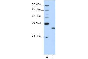 CPXCR1 antibody (20R-1231) used at 0. (CPXCR1 Antikörper  (N-Term))