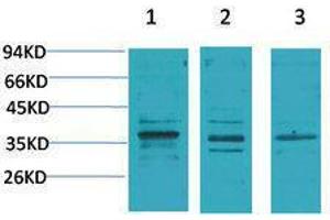 Western Blotting (WB) image for anti-Calcium Channel, Voltage-Dependent, gamma Subunit 2 (CACNG2) antibody (ABIN3181547) (Stargazin Antikörper)