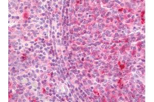Immunohistochemistry (Paraffin-embedded Sections) (IHC (p)) image for anti-Major Histocompatibility Complex, Class II, DP alpha 1 (HLA-DPA1) antibody (Biotin) (ABIN2606268)
