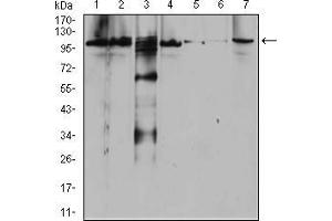 Western Blotting (WB) image for anti-Rab11 Family-Interacting Protein 1 (RAB11FIP1) (AA 130-271) antibody (ABIN5542531)