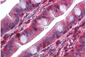 Human Small Intestine (formalin-fixed, paraffin-embedded) stained with TRAF2 antibody ABIN214009 at 5 ug/ml followed by biotinylated goat anti-rabbit IgG secondary antibody ABIN481713, alkaline phosphatase-streptavidin and chromogen. (TRAF2 Antikörper  (N-Term))