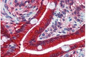 Human Small Intestine: Formalin-Fixed, Paraffin-Embedded (FFPE)