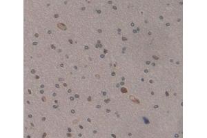 IHC-P analysis of Kidney tissue, with DAB staining. (MEF2A Antikörper  (AA 1-162))