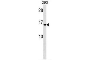 C9orf46 Antibody (C-term) western blot analysis in 293 cell line lysates (35µg/lane). (C9ORF72 Antikörper  (C-Term))