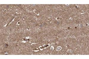Immunohistochemistry (IHC) image for anti-HECT Domain and Ankyrin Repeat Containing, E3 Ubiquitin Protein Ligase 1 (HACE1) (C-Term) antibody (ABIN6262143)