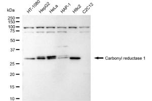 Western blotting analysis using Carbonyl reductase 1 antibody (ABIN7797871).