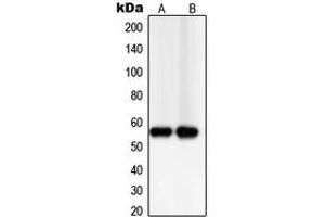 Western blot analysis of TXNRD2 expression in PC12 (A), Jurkat (B) whole cell lysates. (TXNRD2 Antikörper  (C-Term))